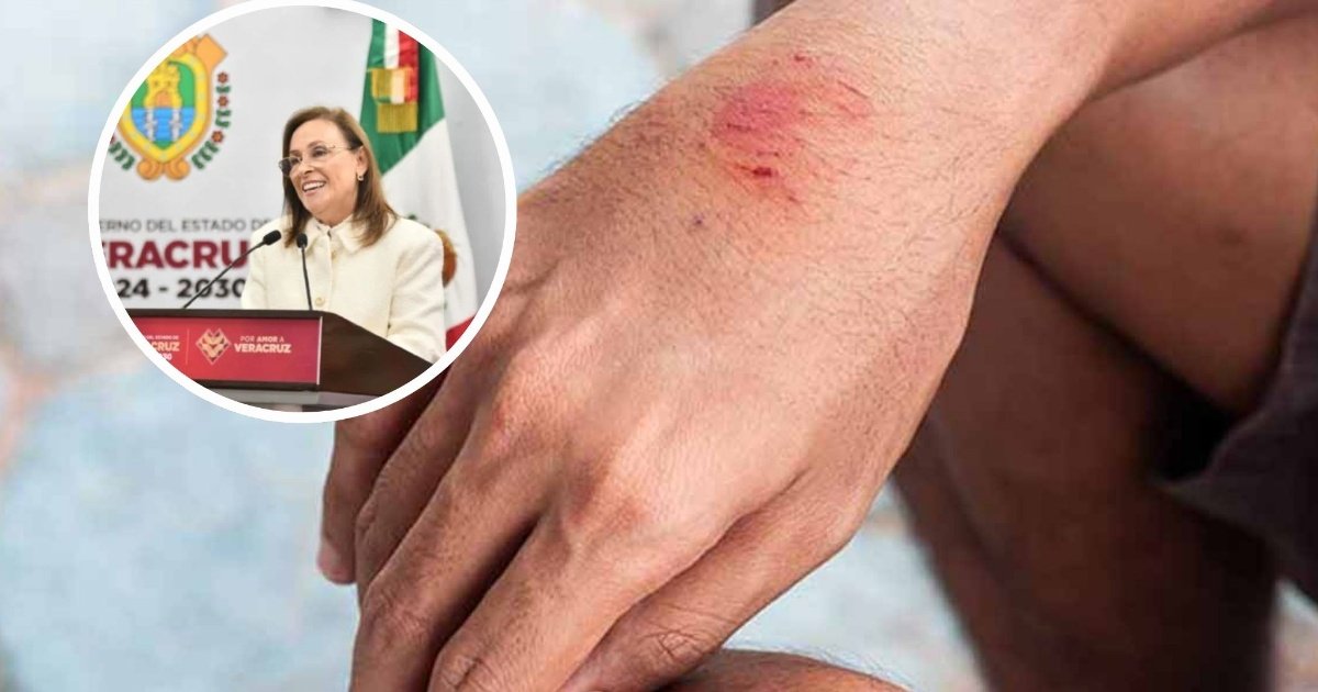 Gobernadora aclara que no hay nuevos casos de rabia en Veracruz